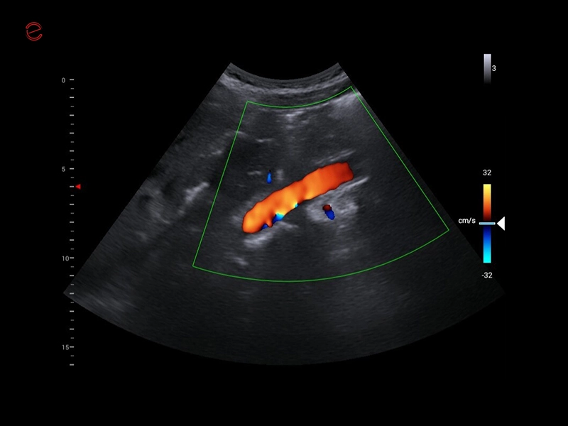 MyLab™X1 Go - GI Abdo CFM