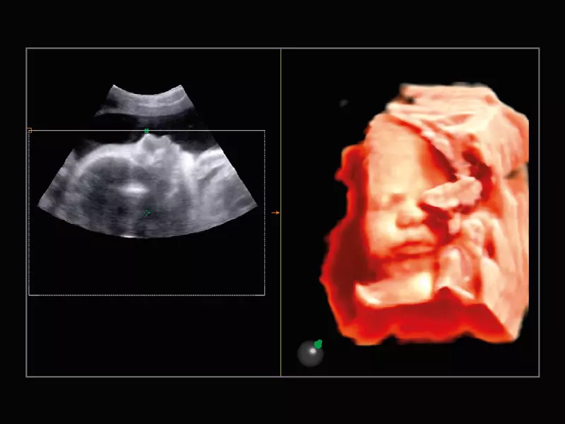 MyLab™X9 - Shared Service 11
