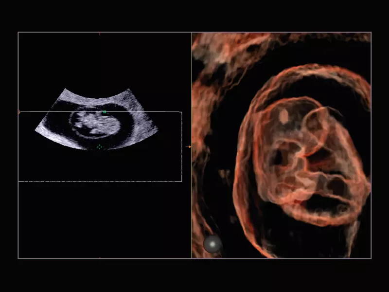 MyLab™X9 - Shared Service 07