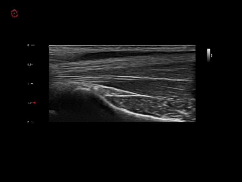MyLab™X1 Go - GI MSK