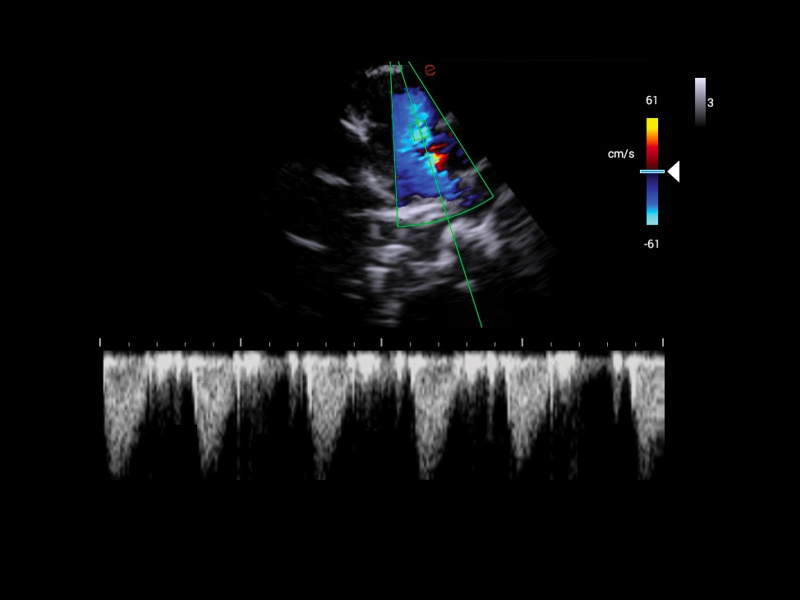 MyLab™X1 Go - Cardiovascualr