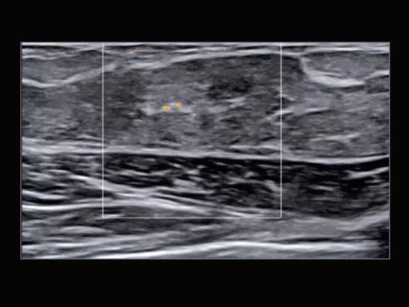 MyLab™X9 - Breast 06