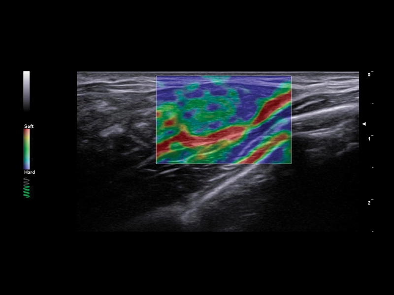 MyLab™A50 - ElaXto