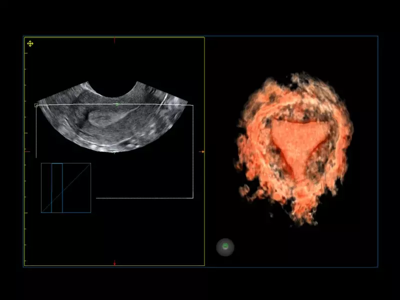 MyLab™Omega eXP - XGlass