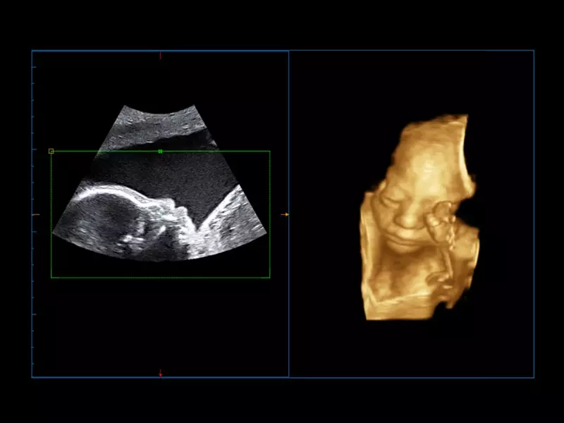 MyLab™Omega eXP - Women's Health 02