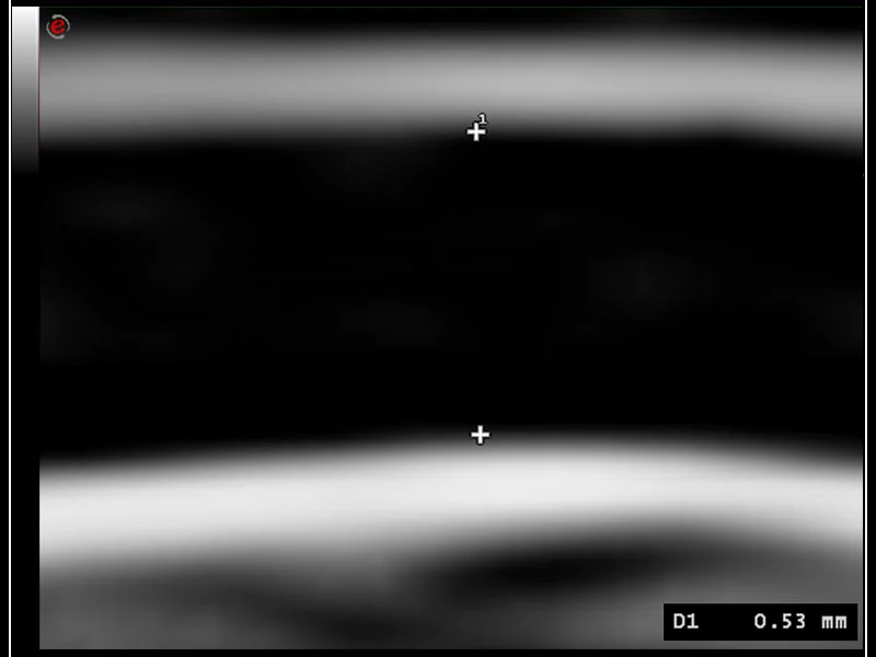 MyLab™9 Platform - High Frequency MSK Imaging with HD Zoom
