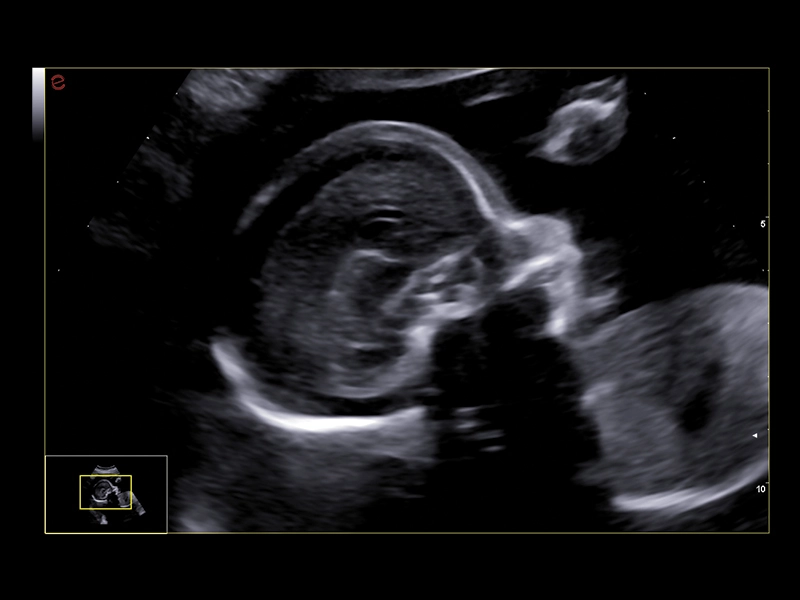 MyLab™A50 - Face profile