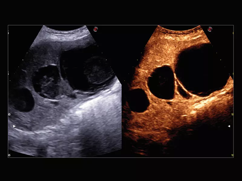 MyLab™X9 - Liver 01