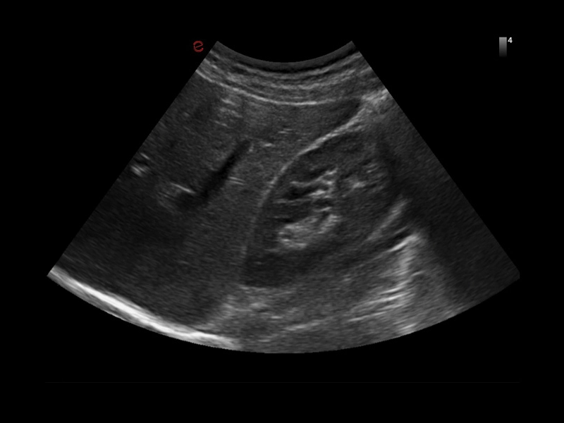 MyLab™X1 Go - General Imaging 04