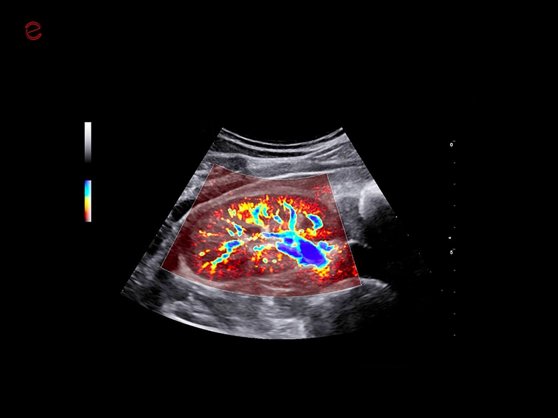 MyLab™C30 - MICROV-NEW