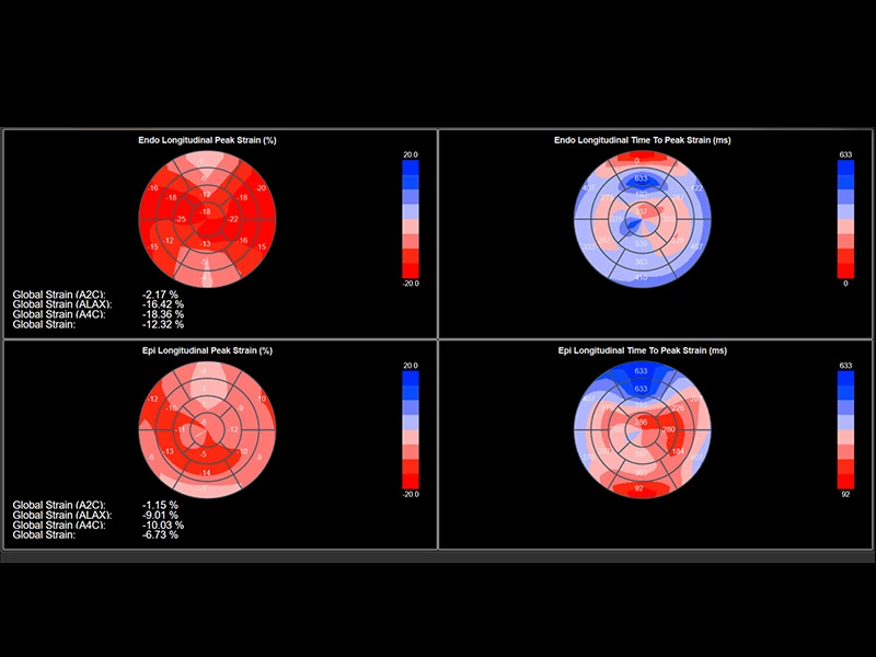 MyLab™X90 - Cardiovascular 03