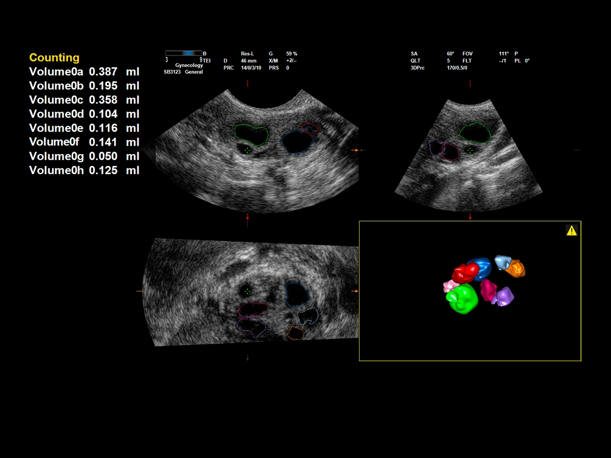 Medically Assisted Procreation