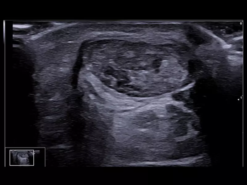 MyLab™X90 - MSK 02