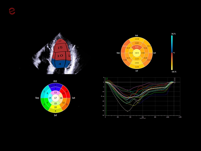 MyLab™C30 - 4d strain
