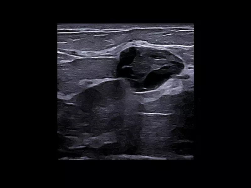 MyLab™X90 - General Imaging 06