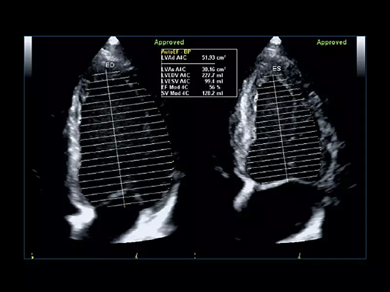 MyLab™Omega eXP - AutoEF