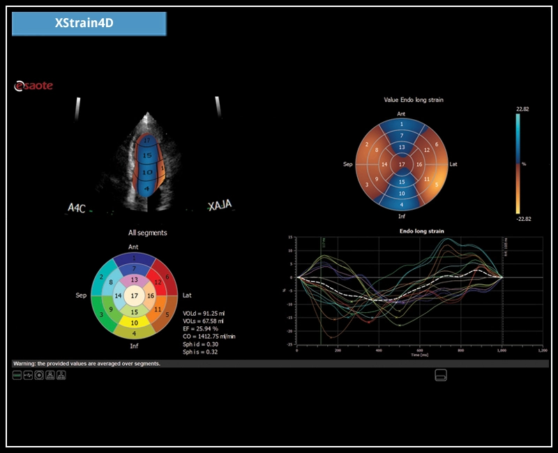 MyLab™X7 - XStrain4D