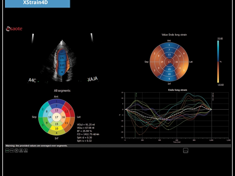 MyLab™X7 - XStrain4D
