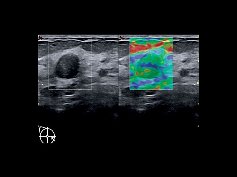 MyLab™X75 - Women's Health 03