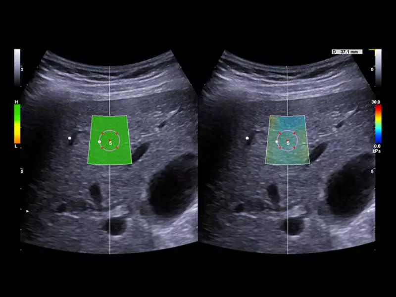 MyLab™X90 - Liver 03