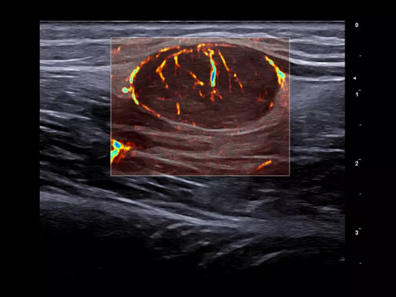 MyLab™X90 - General Imaging 02