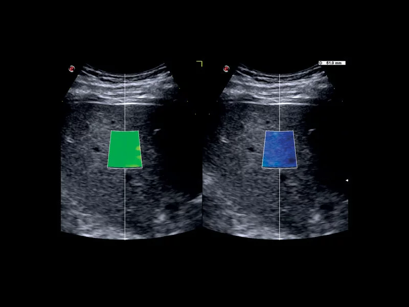 MyLab™X75 - General Imaging 03