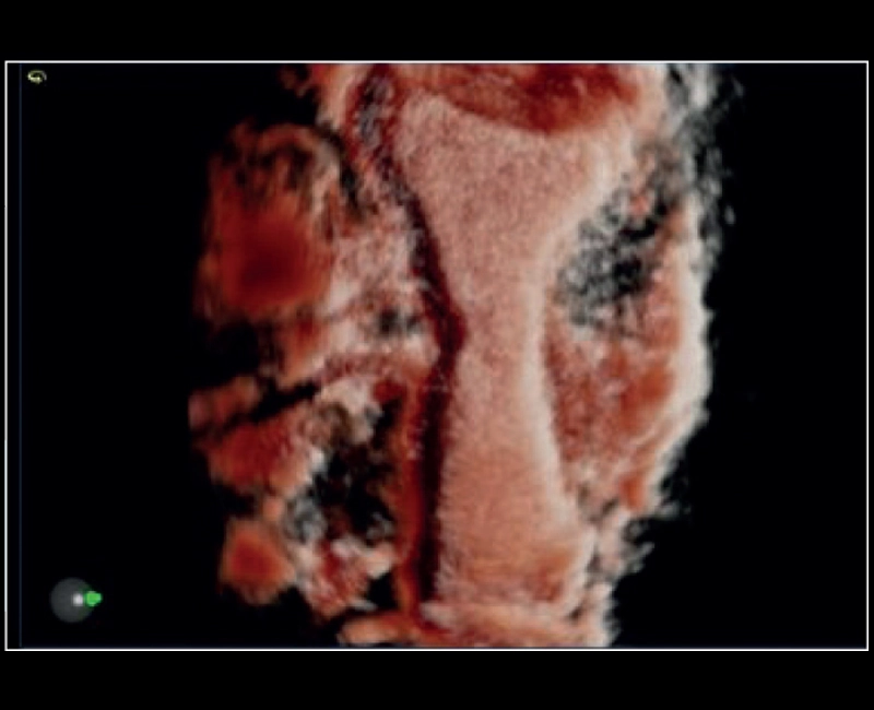 MyLab™X8 Platform - XLight 3D/4D exploration