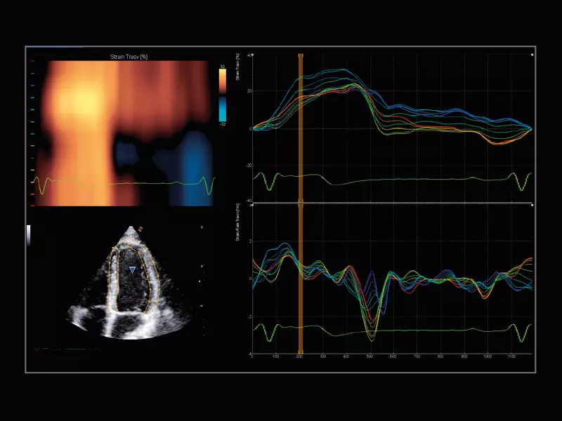 MyLab™X9 - Shared Service 05