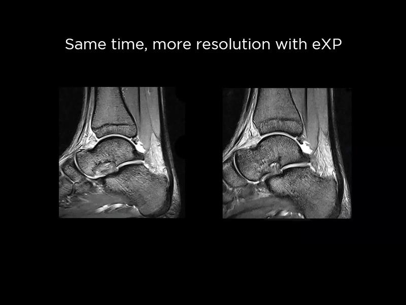  S-scan Open - eXP Ankle