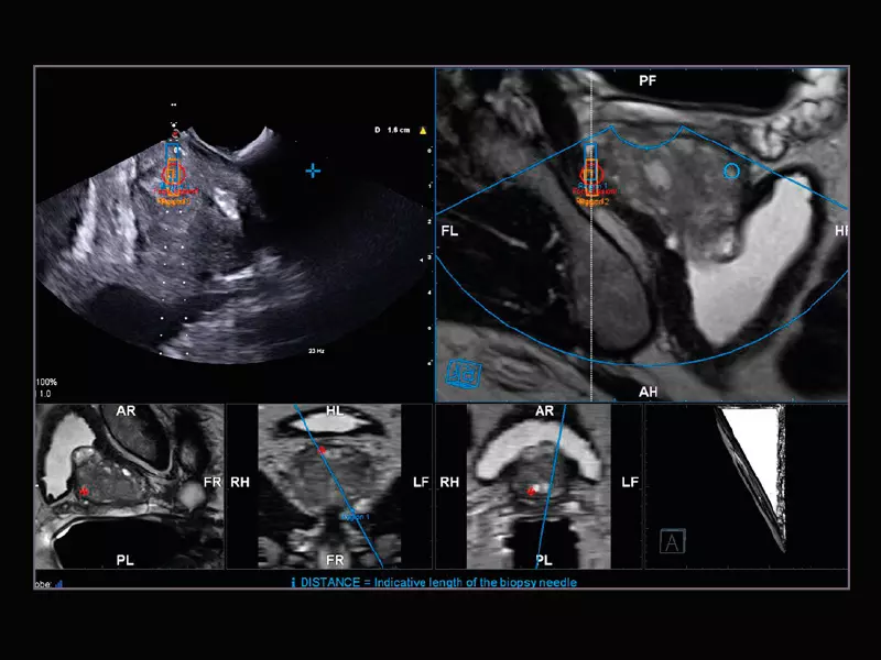 MyLab™X9 - Urology 02