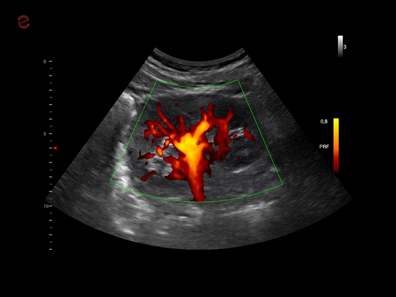 MyLab™X1 Go - GI Kidney