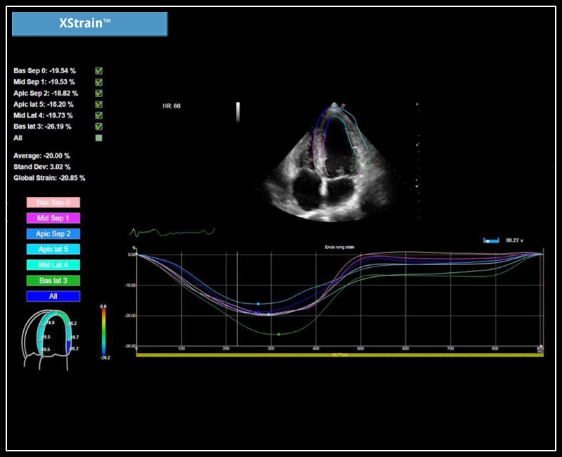 MyLab™X6 - XStrain