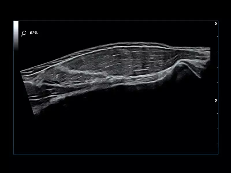 MyLab™Omega eXP - VPan