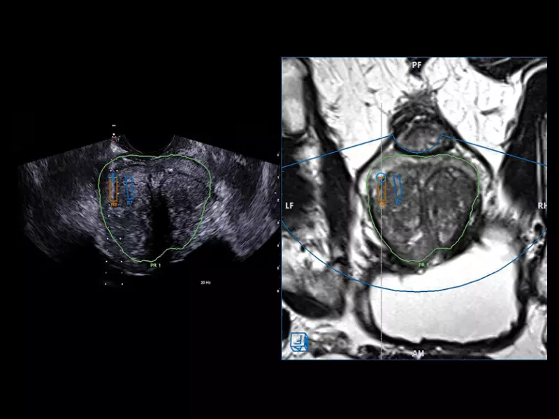 MyLab™X90 - Urology 04