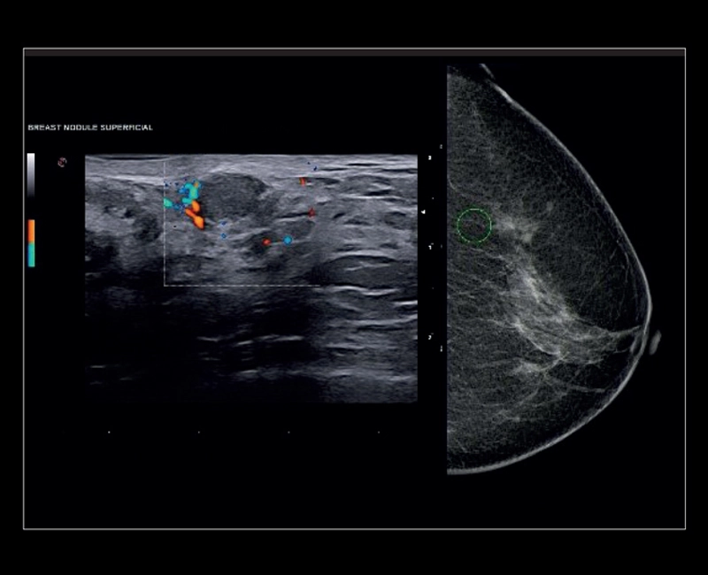 MyLab™X8 Platform - Accurate multimodality diagnosis with Follow Up and BodyMap