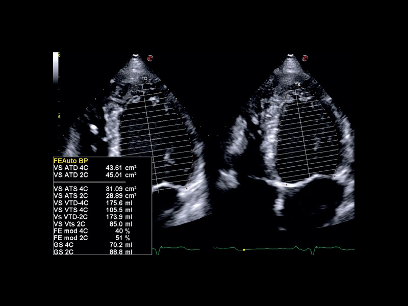MyLab™X75 - Cardiovascular 03