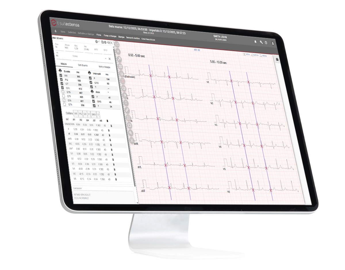 SUITESTENSA ECG Data Management, dedicated to electrocardiography totally based on HTLM5 technology