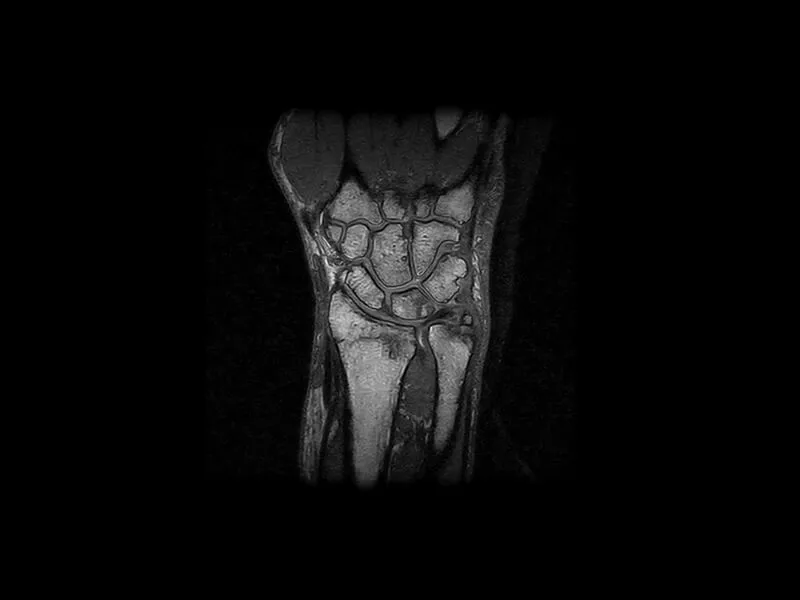 S-scan Open - 3D SHARC cor Wrist