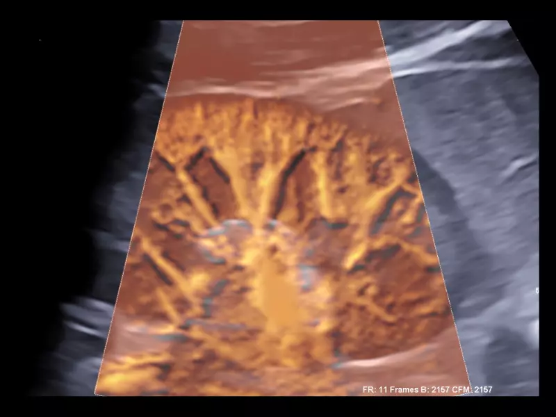 MyLab™X90 - General Imaging 05