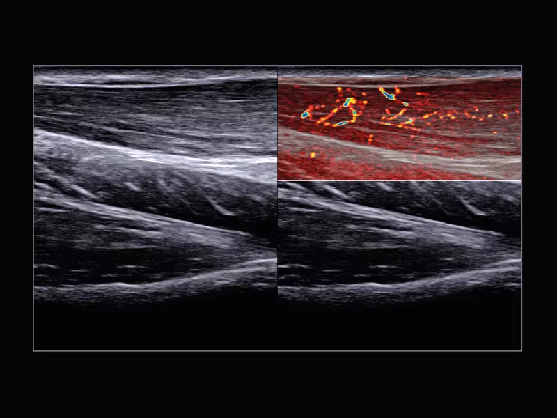 MyLab™X9 - Superficial 03
