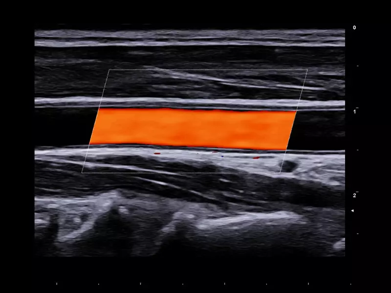 MyLab™X90 - Cardiovascular 01