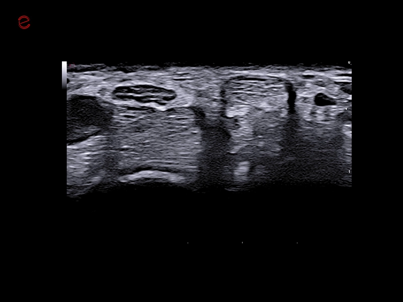 MyLab™C30 - MSK nerve