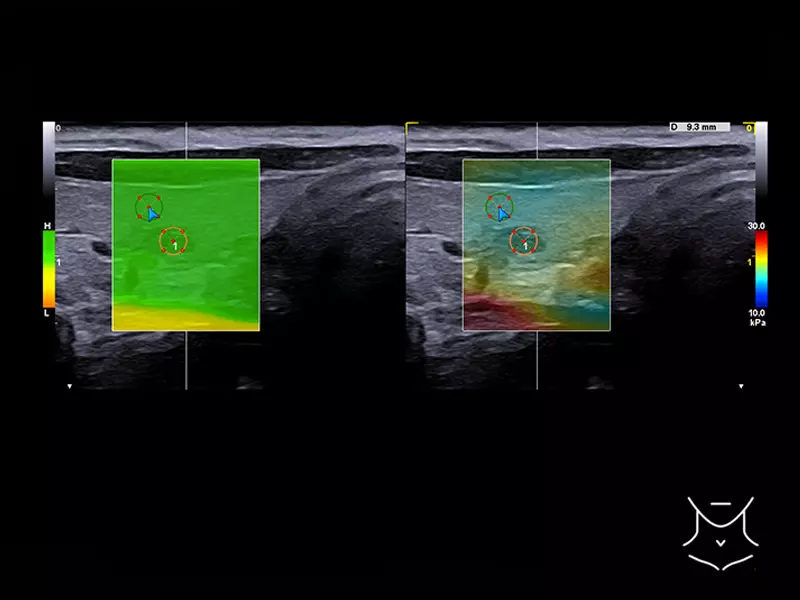 MyLab™X90 - General Imaging 08