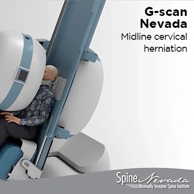 G-scan Spine Nevada diagnosing cervical disc herniation