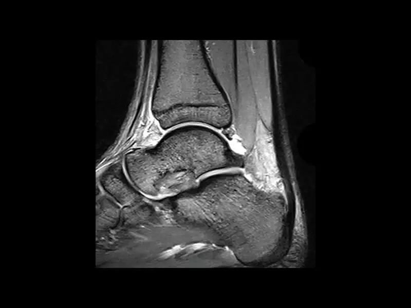 S-scan Open - Ankle eXP 120 resolution 0.56x0.78