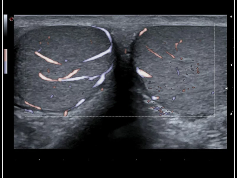 MyLab™9 Platform - XFlow in testis vascularization