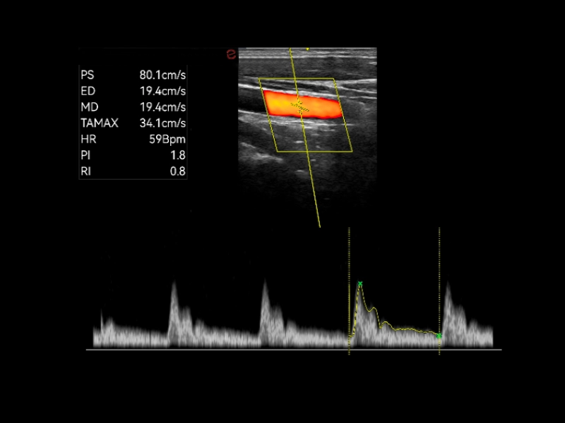 Q7 - Cardiovascular 02