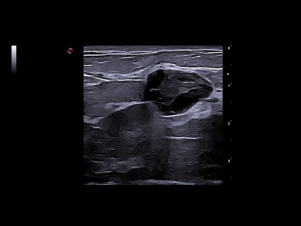 Excellence in breast ultrasound examinations