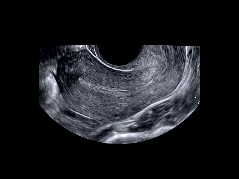 MyLab™X75 - Women's Health 01