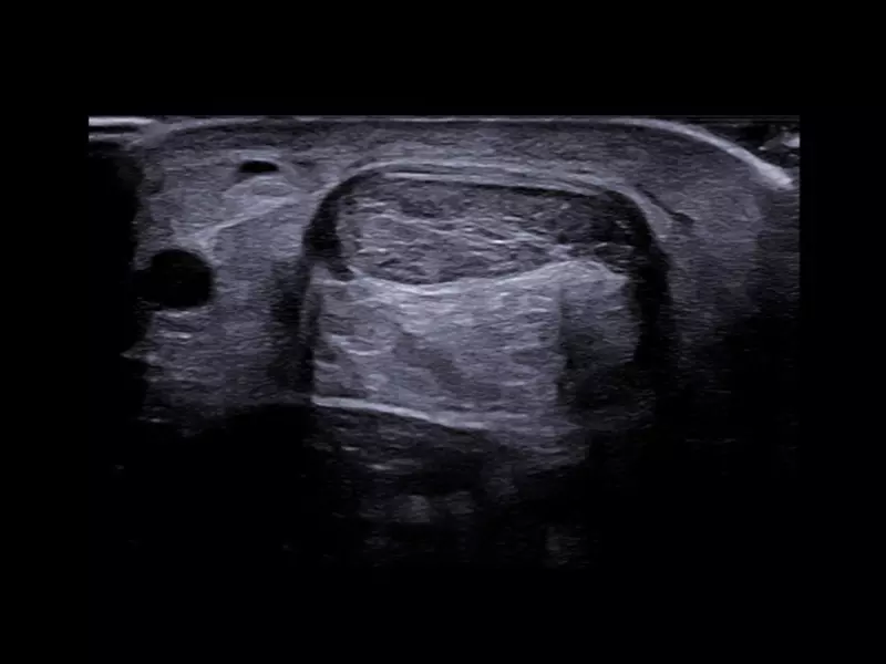 MyLab™X90 - General Imaging 07